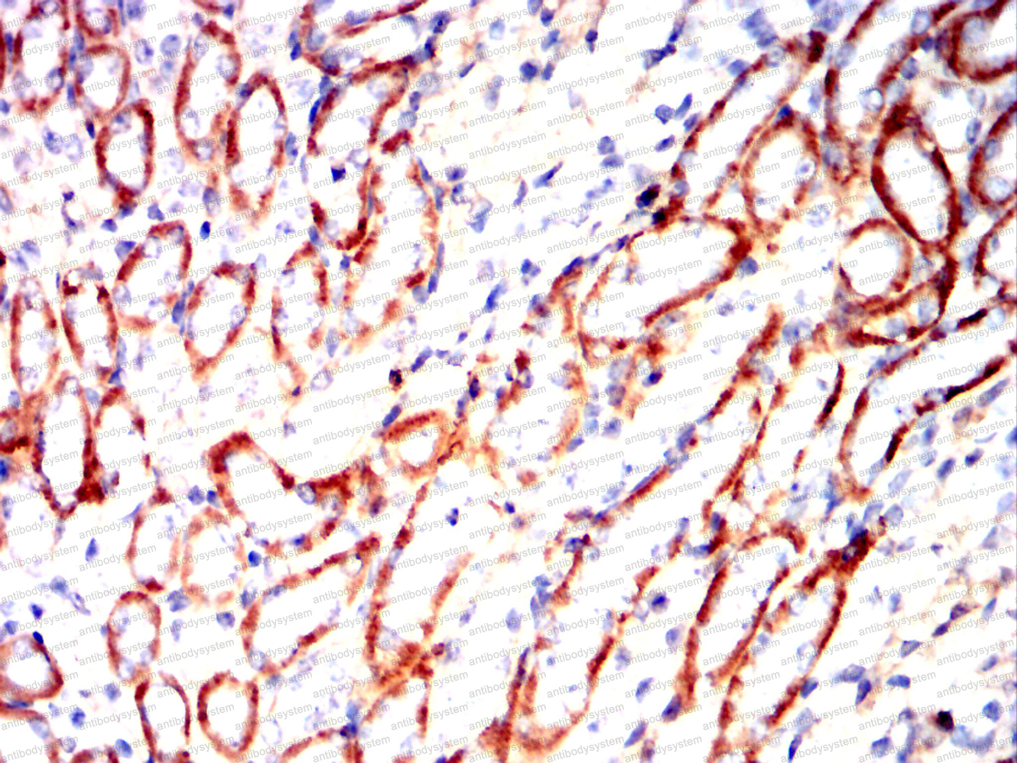 Валидация AntibodySystem RHC33705 (922)