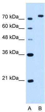 Валидация AssayVector ARM1854(2457)