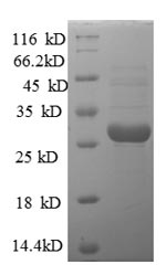 SDS-PAGE