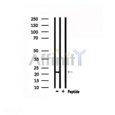 Валидация Affinity DF6241 - 17526