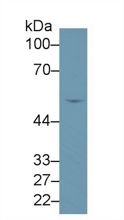 14654
