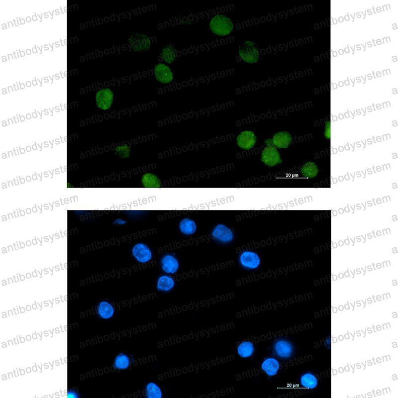 Валидация IF - AntibodySystem RHN88501