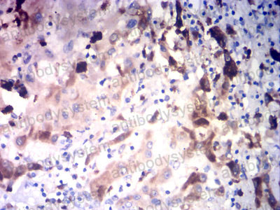 Валидация AntibodySystem RHD08703