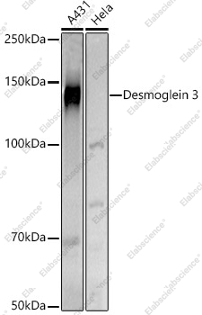 Вестерн-блоттинг, Desmoglein 3, различные клеточные линии