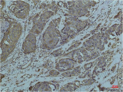 Валидация AntibodySystem RHC84903