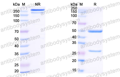 Валидация SDS-PAGE - AntibodySystem DVV03103
