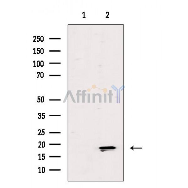 Валидация Affinity DF10015 - 5457