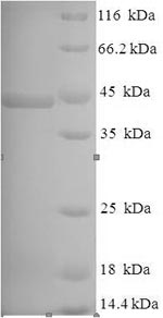 SDS-PAGE
