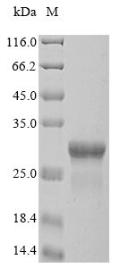 SDS-PAGE