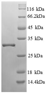 SDS-PAGE