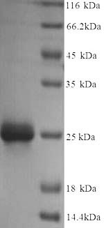 SDS-PAGE