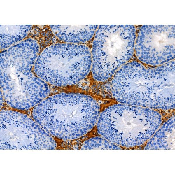 Валидация Affinity DF8524 - 20398