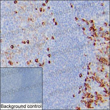 Валидация AntibodySystem RHD36907