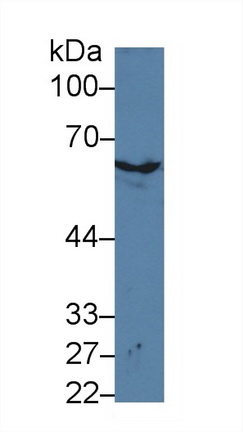 13975