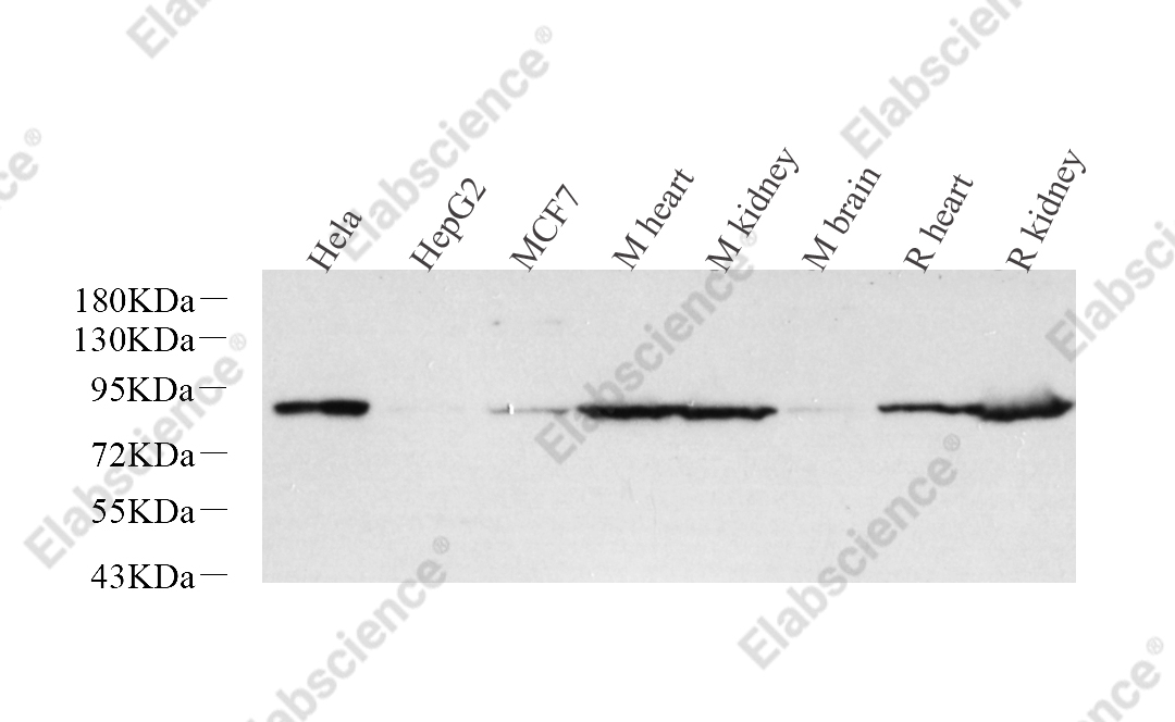 Вестерн-блоттинг, Glucocorticoid Receptor, различные образцы