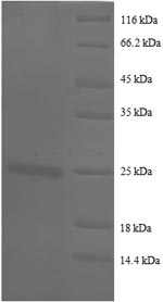 SDS-PAGE