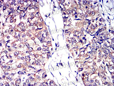 Валидация AntibodySystem RHD33603