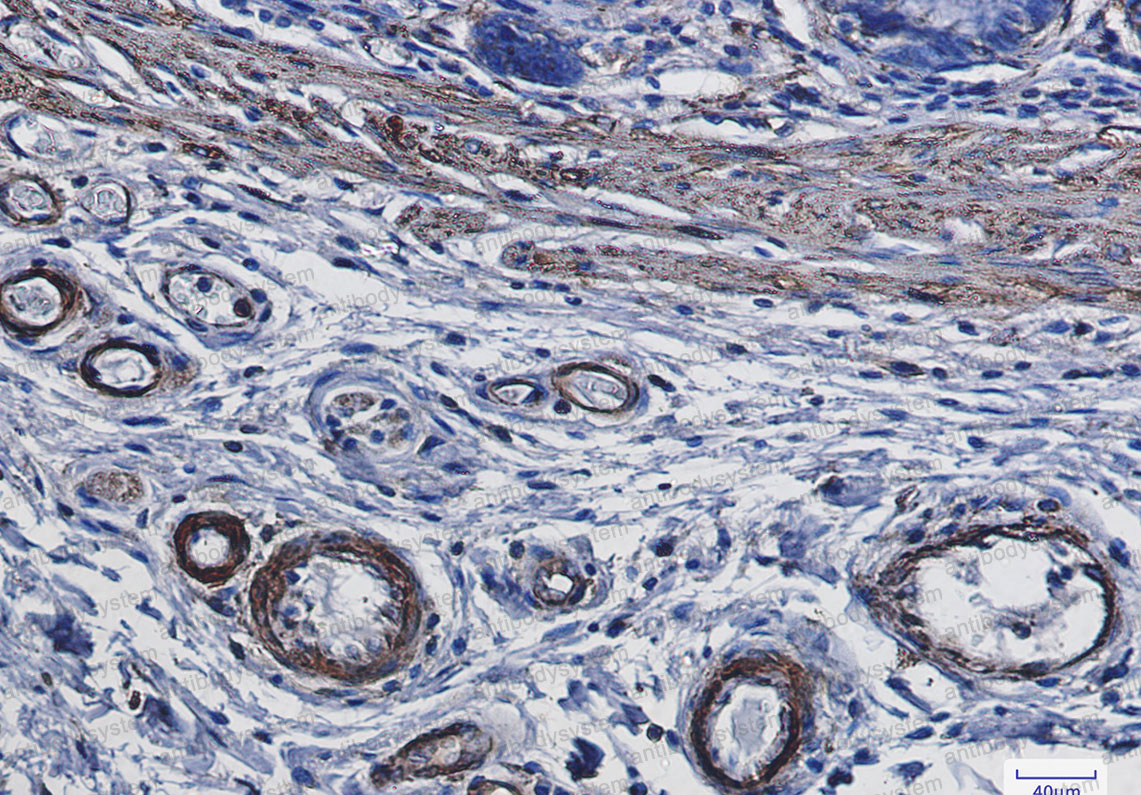 Валидация AntibodySystem RHF52701