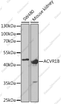 Вестерн-блоттинг, ACVR1B, различные клеточные линии