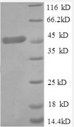 SDS-PAGE