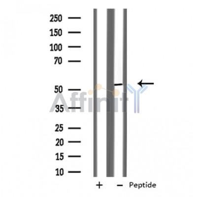 Валидация Affinity DF3535 - 14477