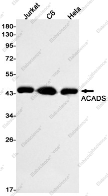 Вестерн-блоттинг, ACADS, клетки Jurkat, C6, HeLa