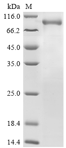SDS-PAGE