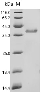SDS-PAGE