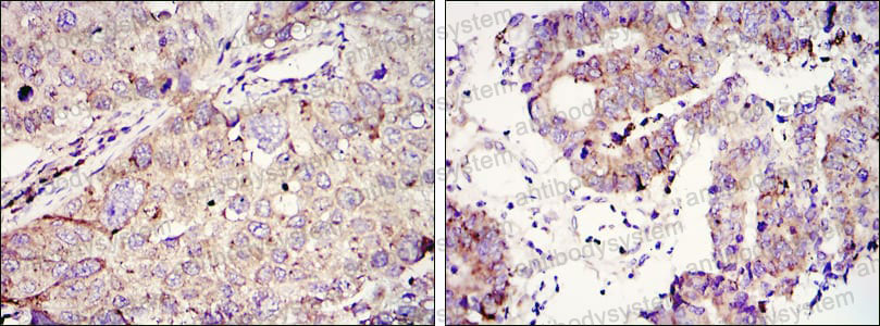 Валидация AntibodySystem RHA11404