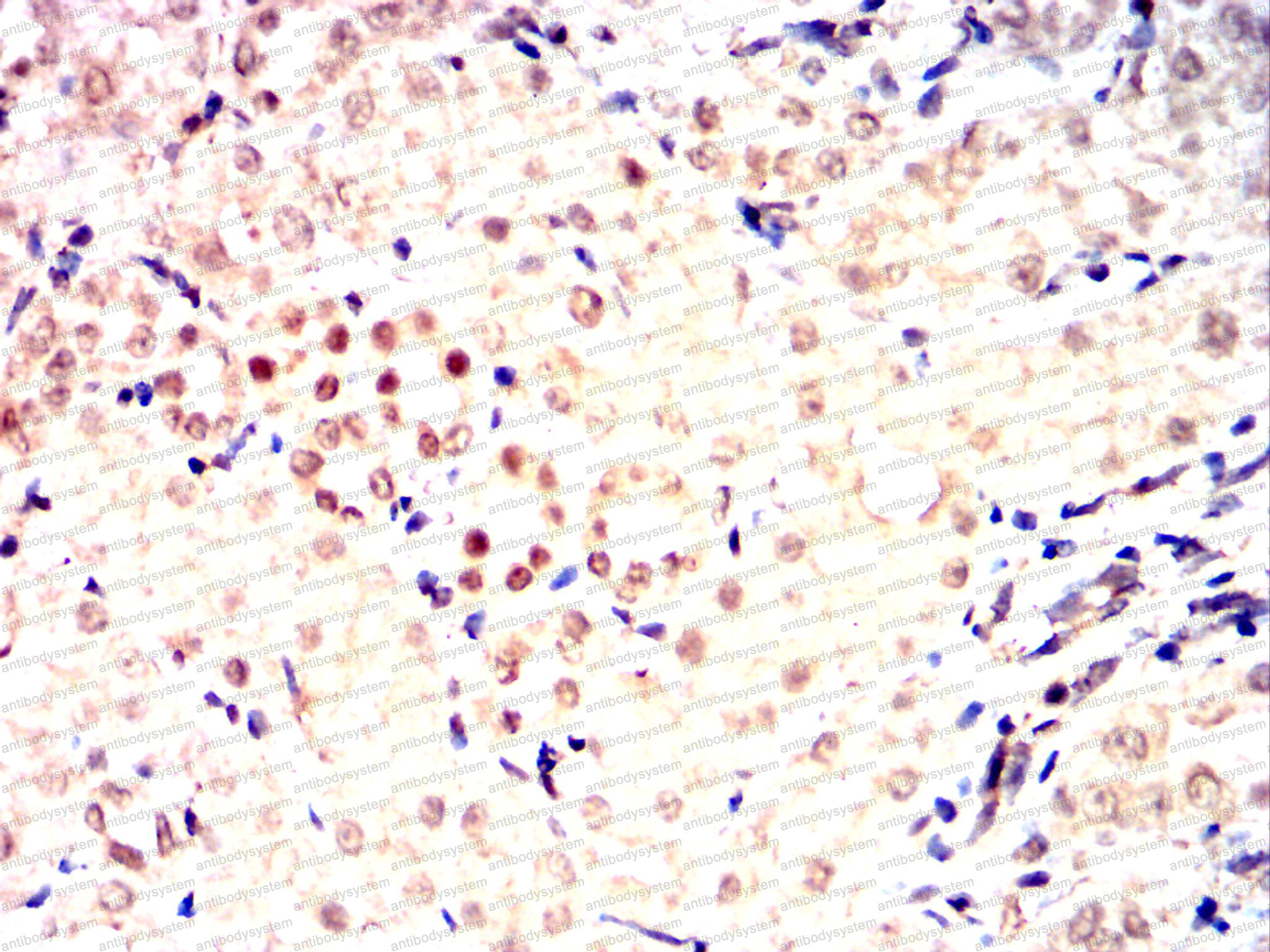 Валидация AntibodySystem RHE50004