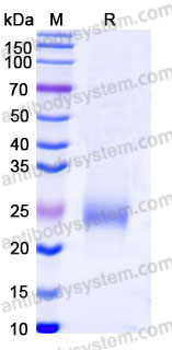 EHB37301, SDS-PAGE