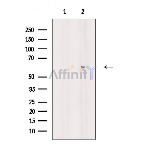 Валидация Affinity DF3768 - 14860