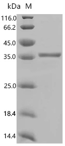 SDS-PAGE