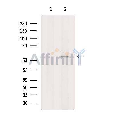 Валидация Affinity DF8975 - 21164