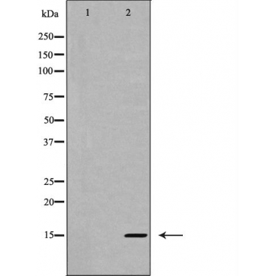 Валидация Affinity AF5123 - 2492