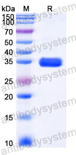 EHC40901, SDS-PAGE