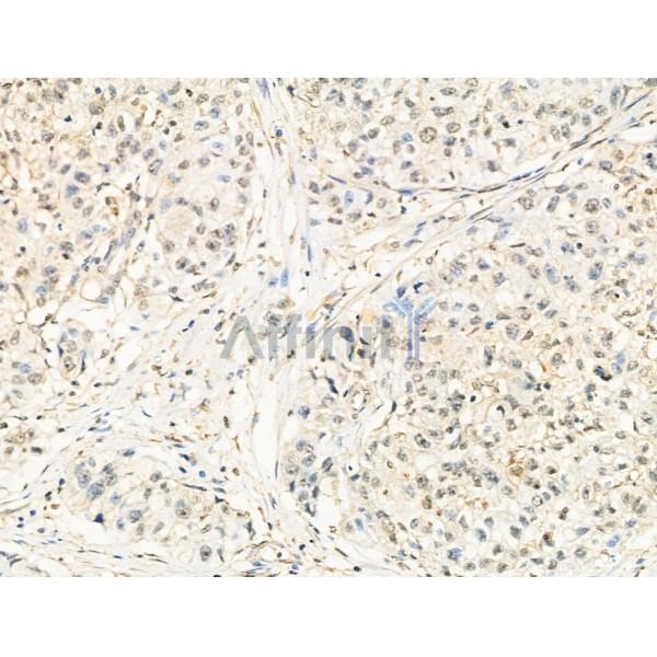 Валидация Affinity DF13360 - 8582