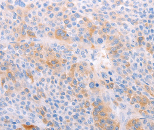 Валидация Elabscience E-AB-12922