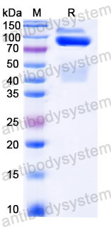 AHC34202, SDS-PAGE