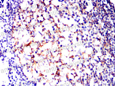 Валидация AntibodySystem RHD74902