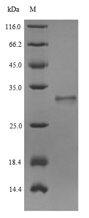 SDS-PAGE