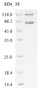 SDS-PAGE