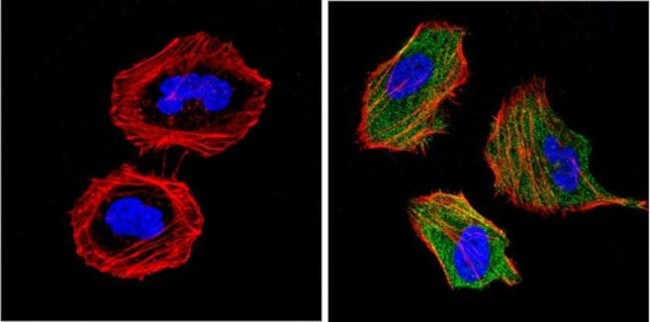Валидация AssayVector ARM1362(993)