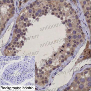 Валидация AntibodySystem RHB19101