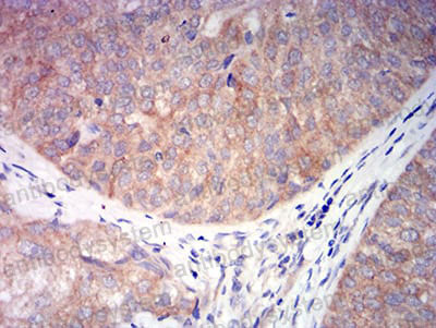 Валидация AntibodySystem RHH20901