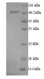 SDS-PAGE