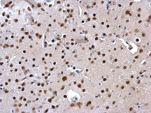 Валидация AssayVector ARM1282(739)