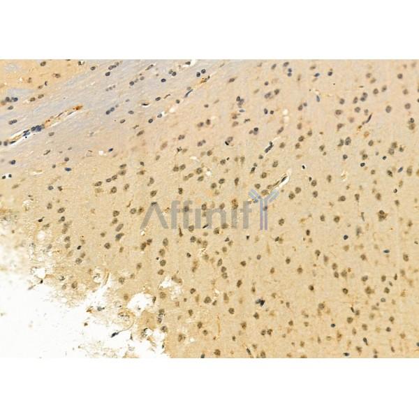 Валидация Affinity DF6410 - 17776