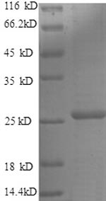 SDS-PAGE