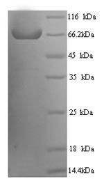 SDS-PAGE